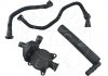 Комплект вентиляції картера BMW 3 (E46)/X3 (E83) 1.6i/2.0i 00-11 (N42/N46) AIC 57400Set (фото 1)